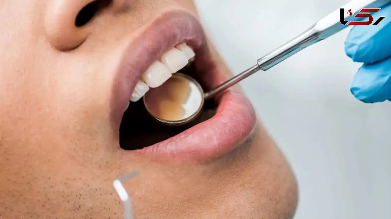 چگونه استرس به آرامی دندان‌ های شما را از بین می‌ برد؟