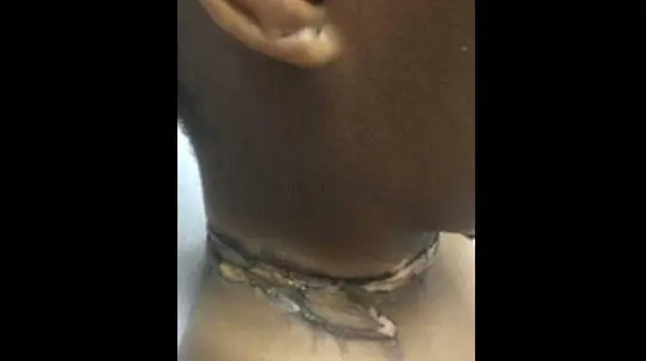 اتصال شارژر آیفون به گردنبند زن جوان / شکل گردنبند روی گردنش هک شد! + عکس