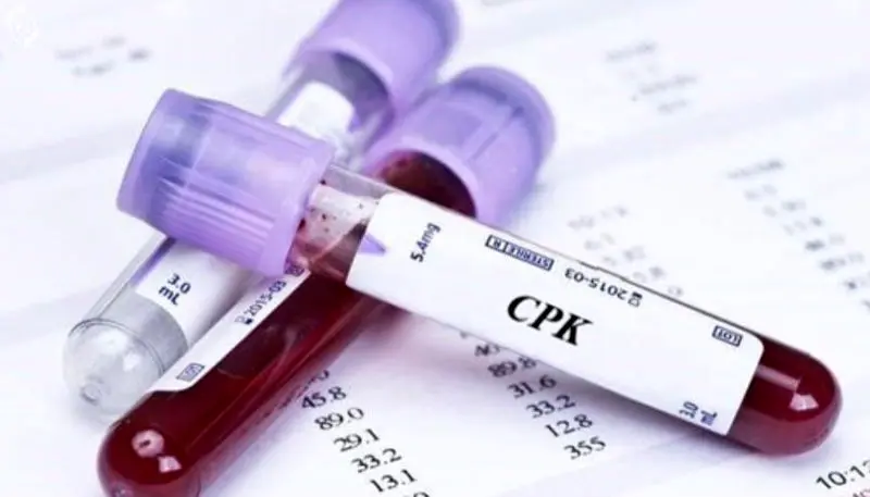 آزمایش CPK
