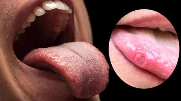 این علامت را روی زبان خود دیدید، نگران شوید!