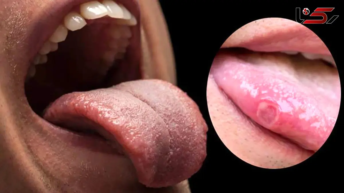 این علامت را روی زبان خود دیدید، نگران شوید!