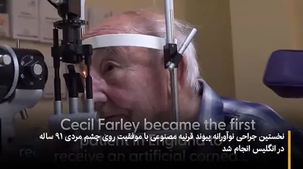 پیوند قرنیه مصنوعی روی مرد مسن در انگلیس + فیلم