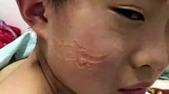 اتفاقی که با به خواب رفتن یک کودک روی دفتر تکالیفش برای او رخ داد + عکس