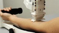 آزمایش خون با ربات!+ فیلم