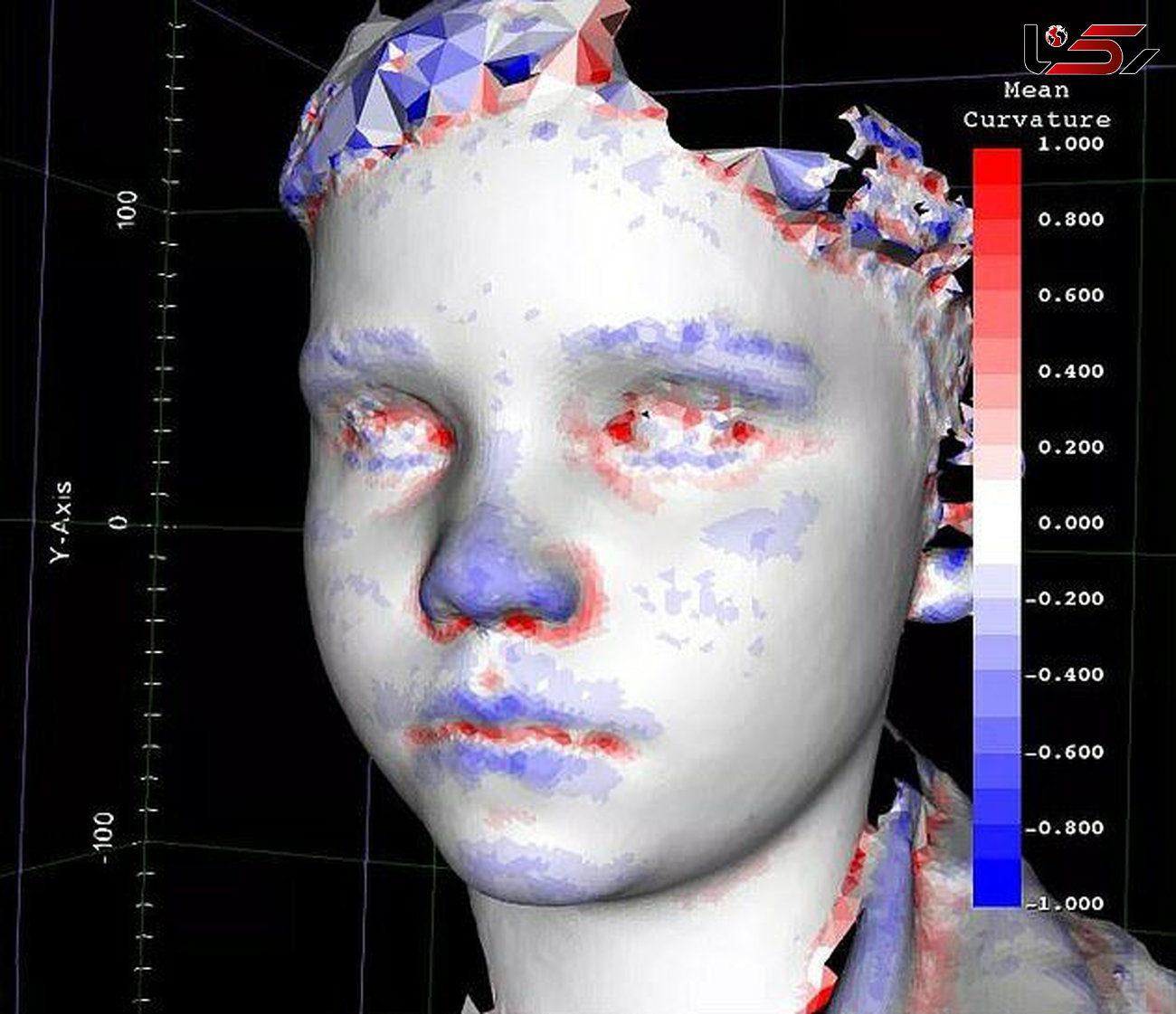 نرم افزار تشخیص چهره در رصد بیماری های نادر کودکان