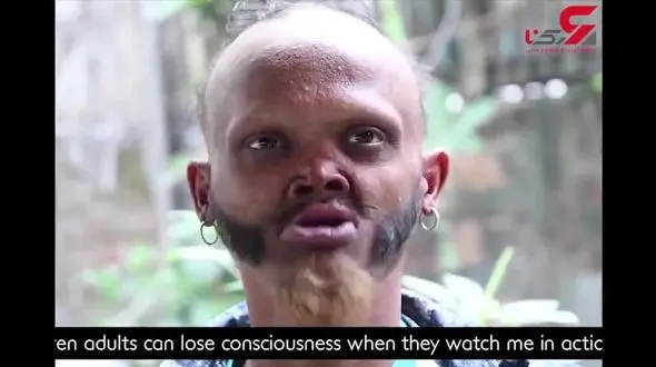 درازترین زبان دنیا+فیلم