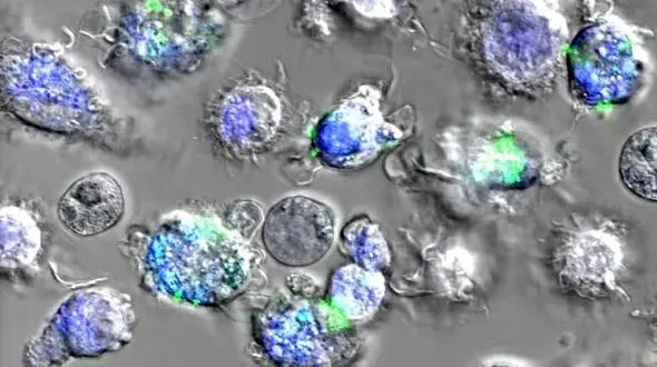 استفاده از تار عنکبوت برای رهایی از سرطان