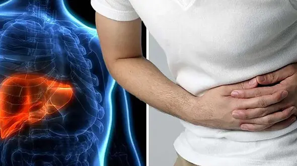 پنج علامت مهم ابتلا به کبد چرب که در ظاهر شما عیان می شود