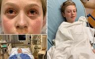 Boy, 11, left with red eyes and hands after contracting rare Covid-linked illness