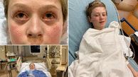 Boy, 11, left with red eyes and hands after contracting rare Covid-linked illness