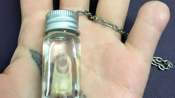 اقدام عجیب دختری که انگشت خود را قطع کرد و ..! + عکس