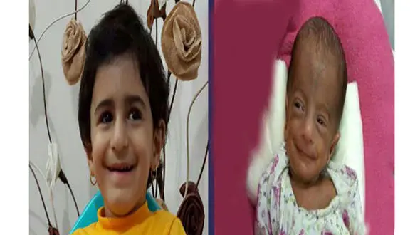 کم وزن ترین نوزاد بابل سه ساله شد +عکس