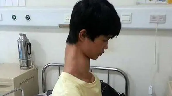 زندگی دردناک پسر زرافه ای + عکس