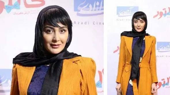 حمله وحشیانه یک مرد به بازیگر مشهور زن در تهران + عکس قبل و بعد از حمله