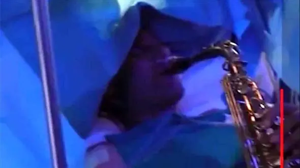 ببینید/ ساکسیفون نوازی یک بیمار هنگام جراحی مغز در ایتالیا