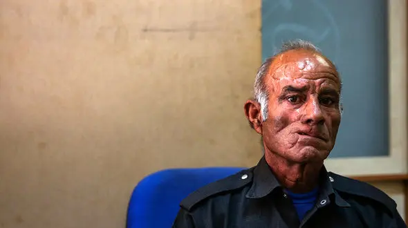 روایت عباس 60 ساله از حمله خونین هیولای دشت ایلام به او + عکس 