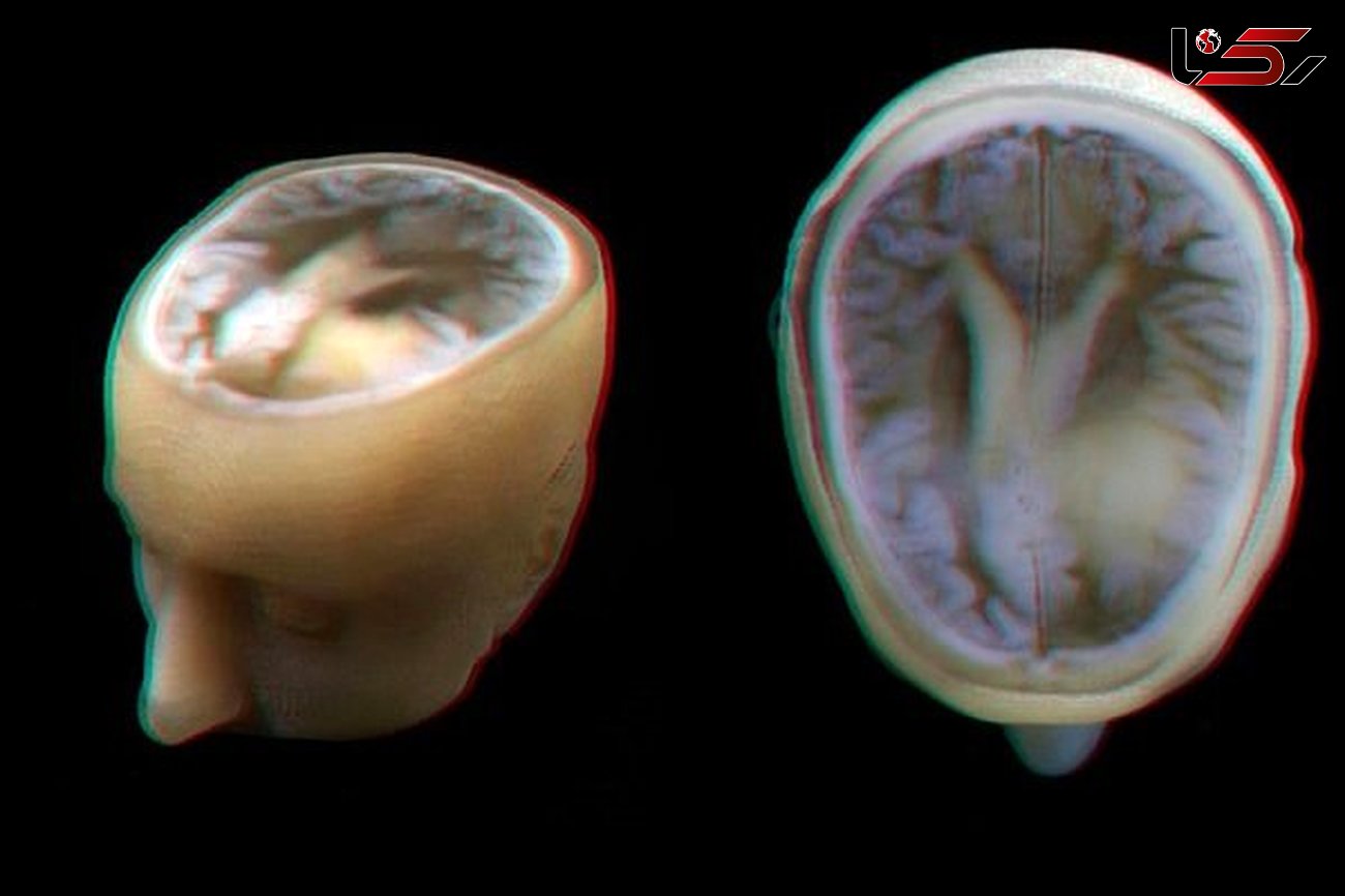 به کمک چاپگر سه بعدی مدل دقیق مغز انسان طراحی شد