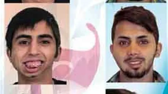 معجزه در صورت له شده جوان ایرانی ! / مرحله به مرحله با تغییره چهره! + فیلم