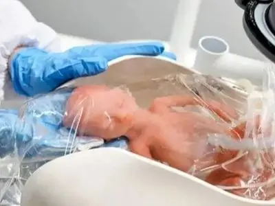 نجات نوزادان زودرس با تکنولوژی رحم مصنوعی