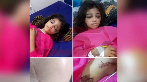 جزییات جدید از  شکنجه سوزناک المیرا نارویی 10 ساله در خانه مادربزرگش ! / با آب جوش او را سوزاندند ! + فیلم