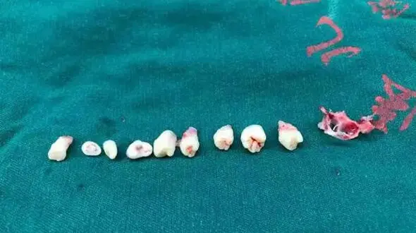 دهان این کودک در مغزش بود! + عکس 
