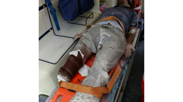 صحنه دلخراش از پای قطع شده جوان خراسانی + جزئیات حادثه