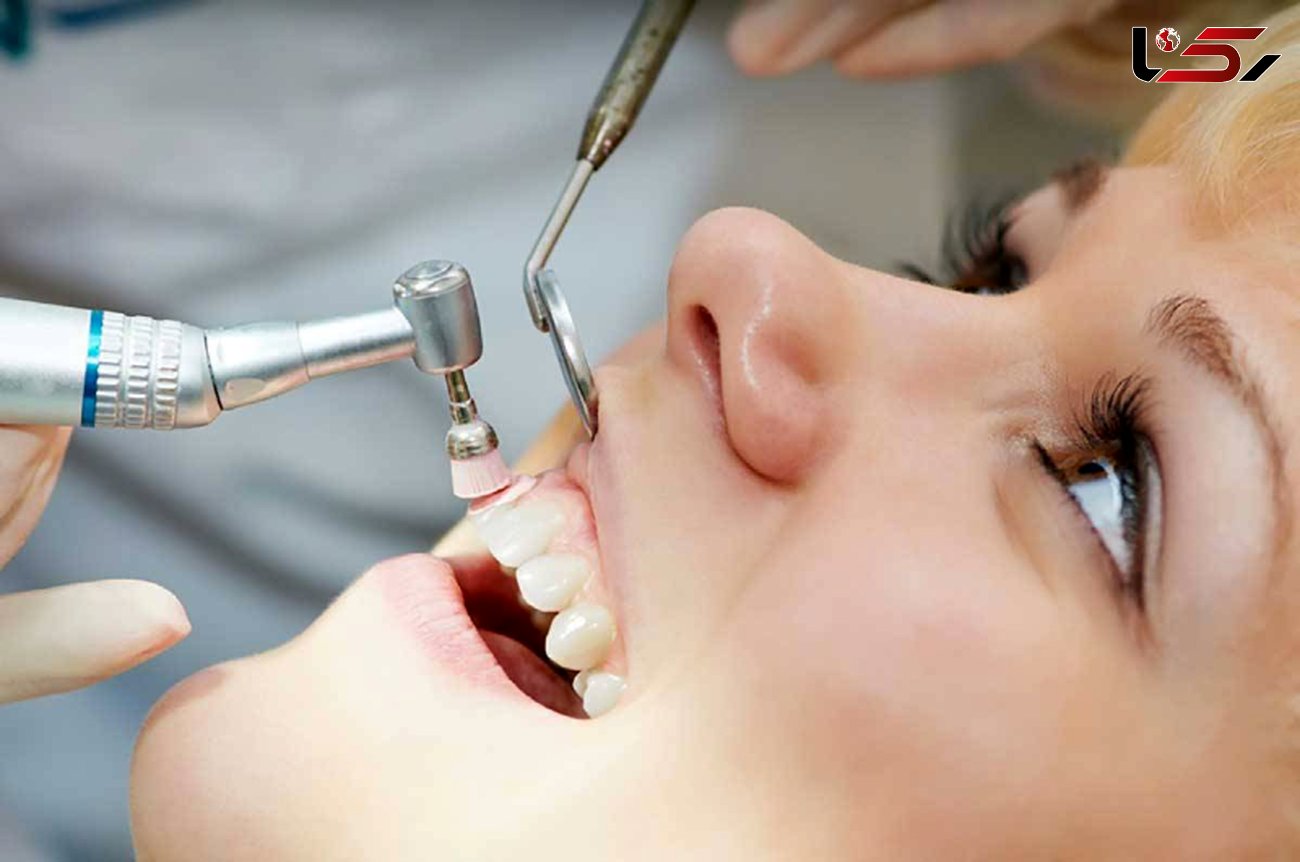 آیا جرم گیری دندانهایتان را لق می کند؟