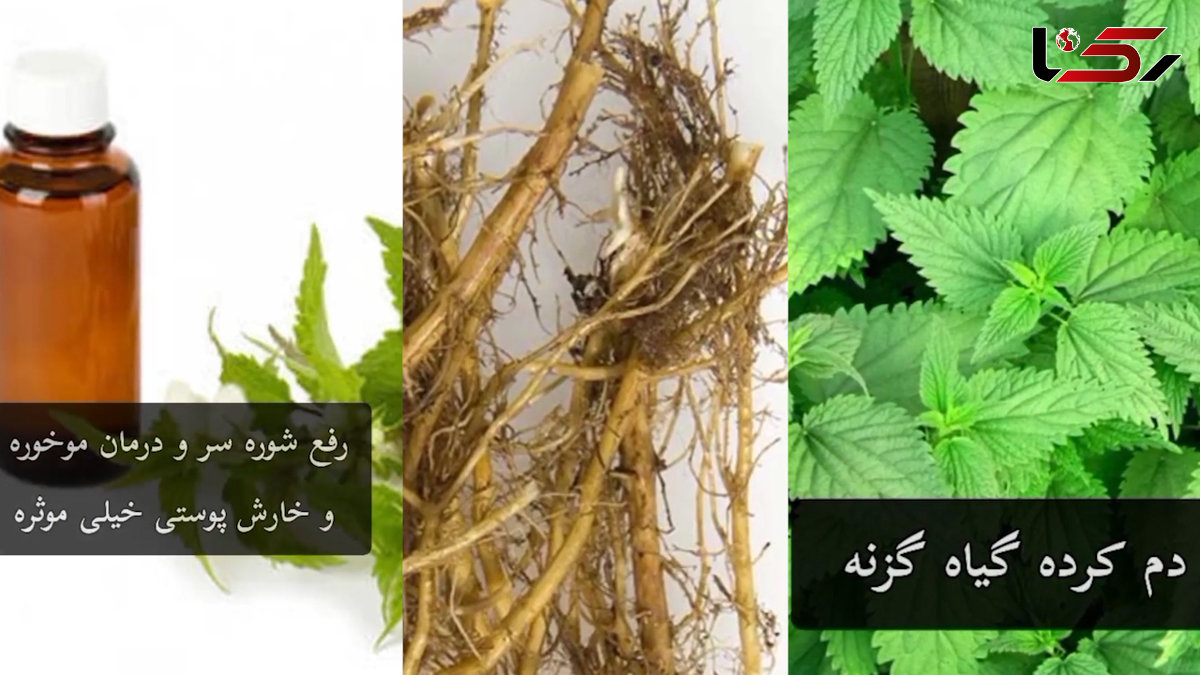 فواید دمنوش گزنه و روغن گزنه + فیلم