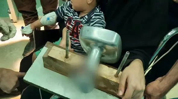 چرخ گوشت انگشت دست پسر 2 ساله را چرخ کرد / در بروجن رخ داد + عکس