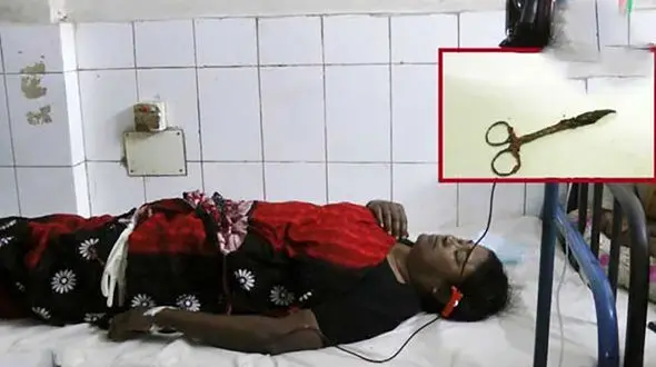 خارج کردن قیچی از شکم یک زن پس از ۲۰ سال! + عکس 