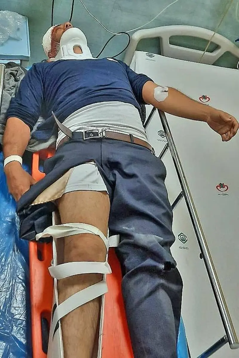 آتش نشان مجروح
