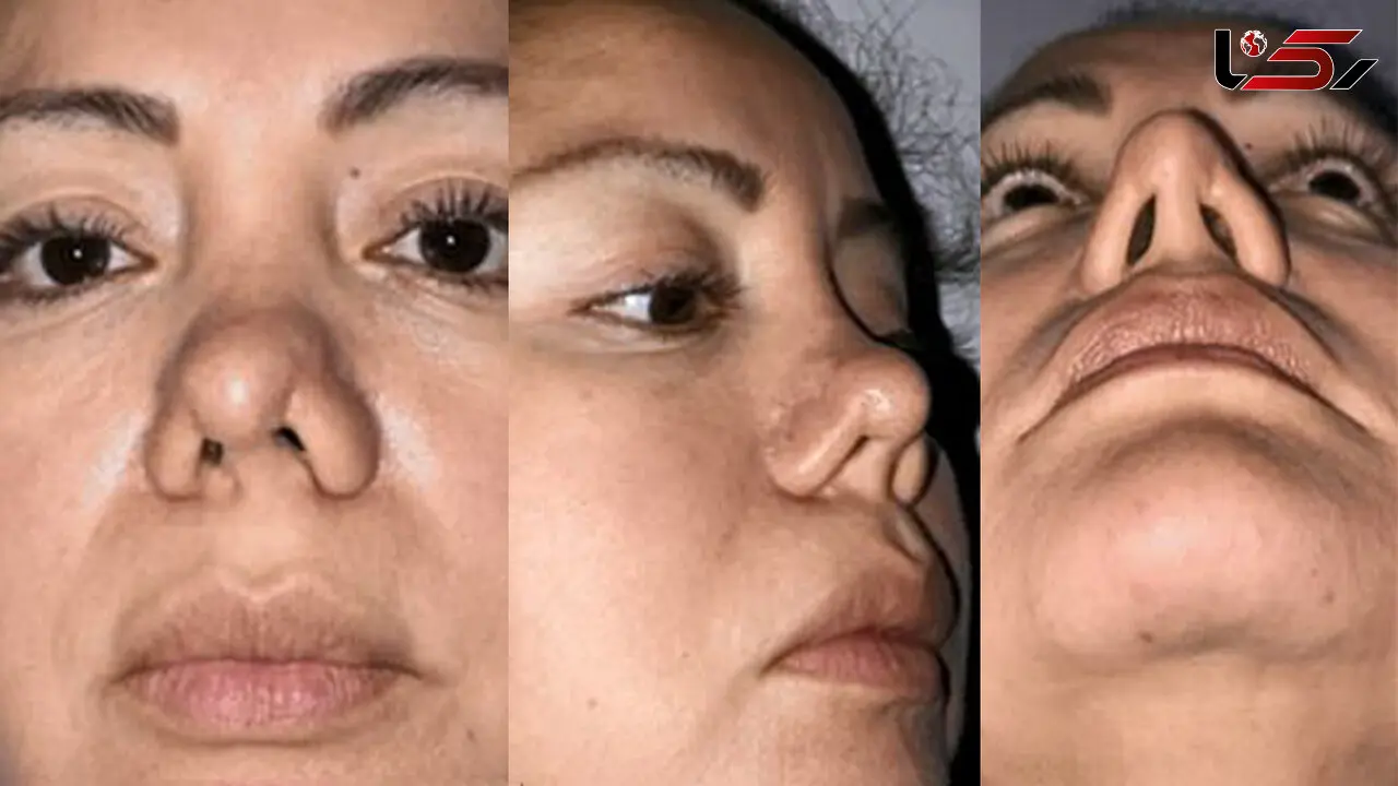 اقدام احمقانه پزشک جراح زیبایی با زن جوان در اتاق عمل + عکس