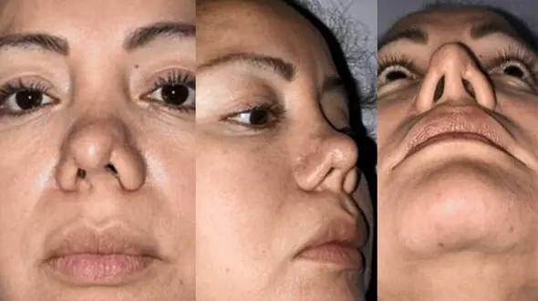 اقدام احمقانه پزشک جراح زیبایی با زن جوان در اتاق عمل + عکس