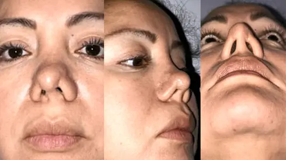 اقدام احمقانه پزشک جراح زیبایی با زن جوان در اتاق عمل + عکس