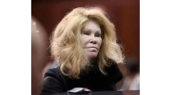 انجام جراحی پلاستیک برای شبیه شدن به گربه+عکس