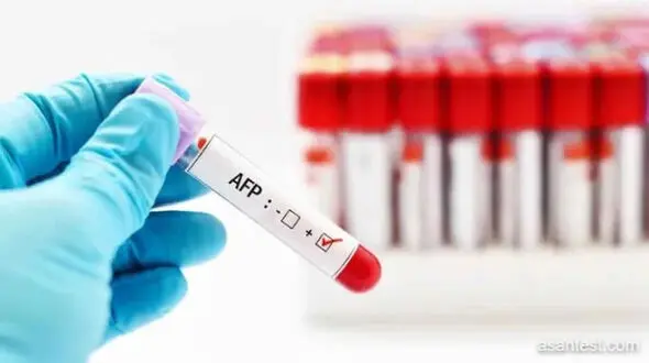اجرای الگوی جدید غربالگری سرطان در ایران؛ تمرکز بر پیشگیری و درمان سه سرطان شایع