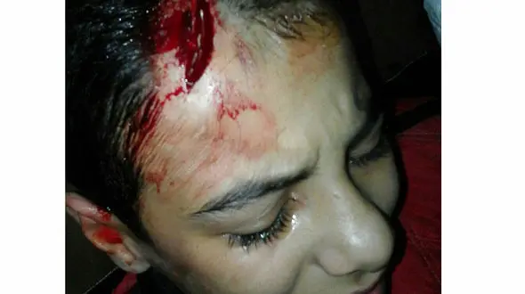 چه کسی این بلا را بر سر پسر دستفروش تالشی آورده است؟ + عکس