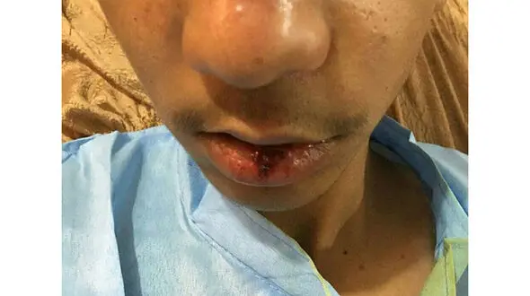 ضرب و شتم شدید دانش‌آموز جیرفتی توسط مدیر مدرسه + عکس
