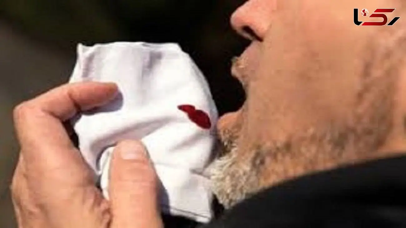 ۲۴ مارس، روز جهانی بیماری سل ؛ راه های تشخیص بیماری و نشانه های آن