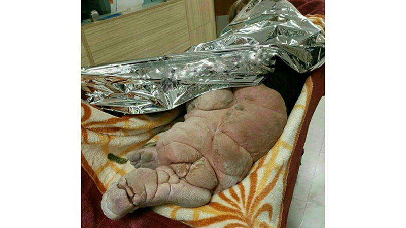 تصویری وحشتناک از یک بیمار تهرانی / او کرم خاکی نیست!
