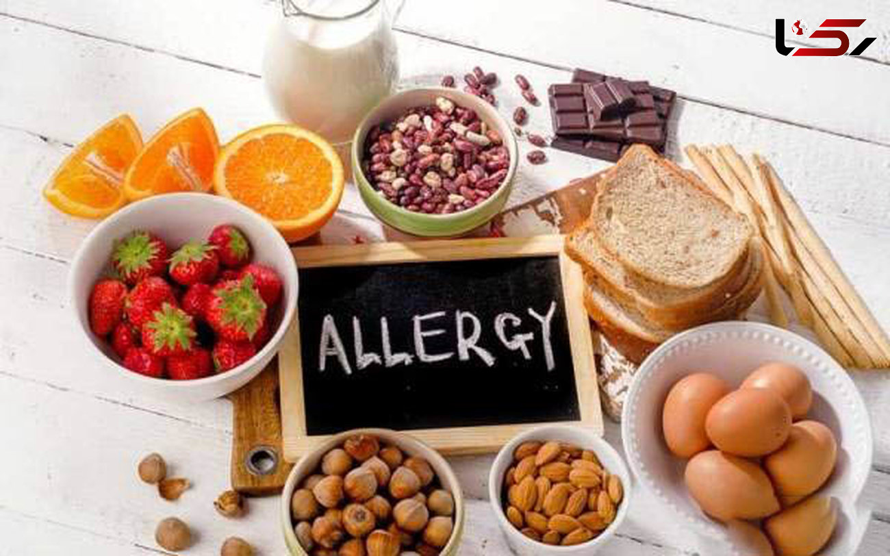 نشانه های آلرژی غذایی را بشناسید