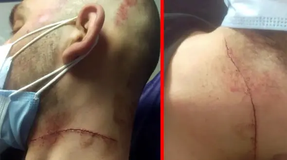 شرور خطرناک گردن جوان تهرانی را با چاقو برید + فیلم تلخ