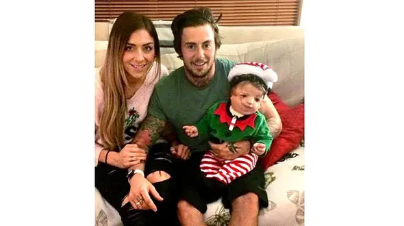 چهره این نوزاد پس از تولد مادرش را به وحشت انداخت + تصاویر 