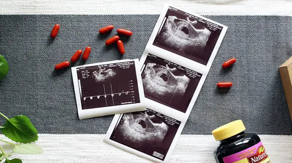 مقایسه مشکلات سزارین و زایمان طبیعی