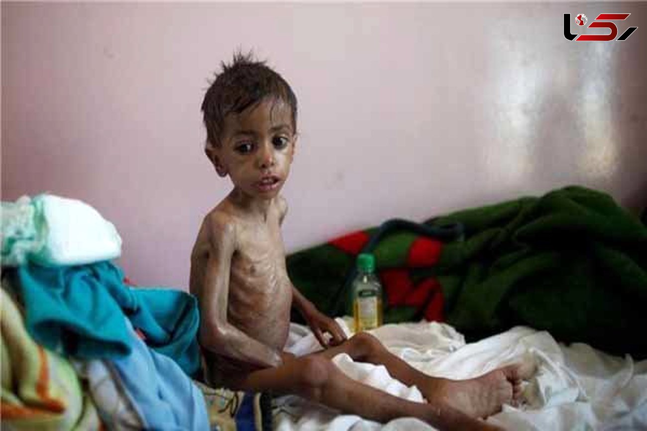 بیش از ۸ میلیون گرسنه در یمن وجود دارد