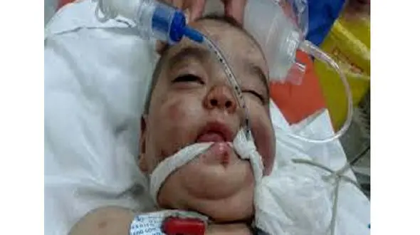 لبخند زندگی به «یسنا» دختر 2 ساله هرمزگانی + عکس