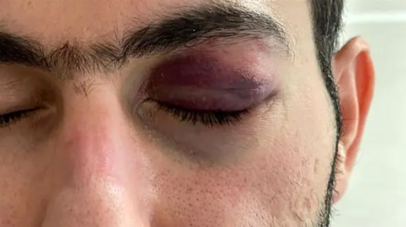 ماجرای حمله مرد جوان به دکتر تقی زاده در بندرعباس + عکس