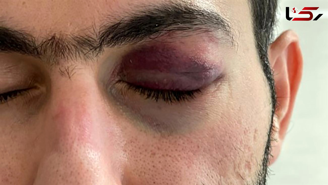 بازداشت عامل حمله دردناک به پزشک بندرعباسی + عکس