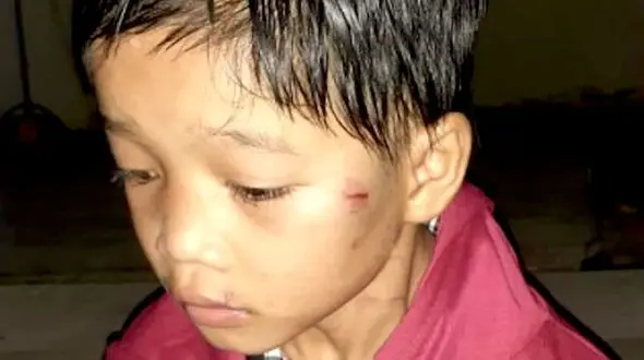 اقدام عجیب یک پدر و مادر با دختر 8 ساله شان + عکس