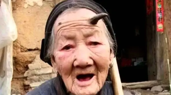 چرا برخی انسان‌ ها شاخ درمی‌ آورند؟ رازهای عجیب و شگفت‌ انگیز!